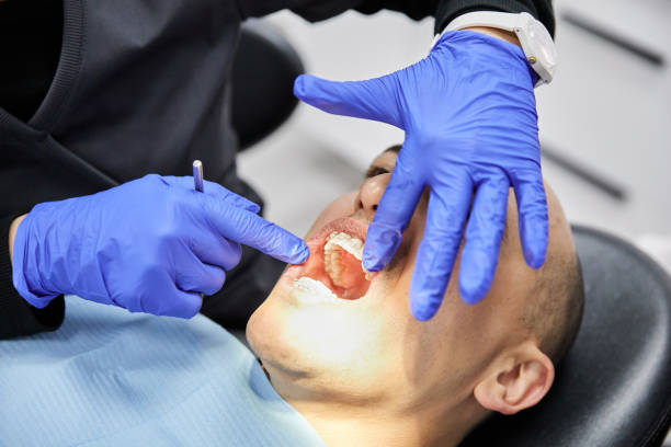 Best Emergency Dentist for Knocked-Out Tooth in Hutchison, VA