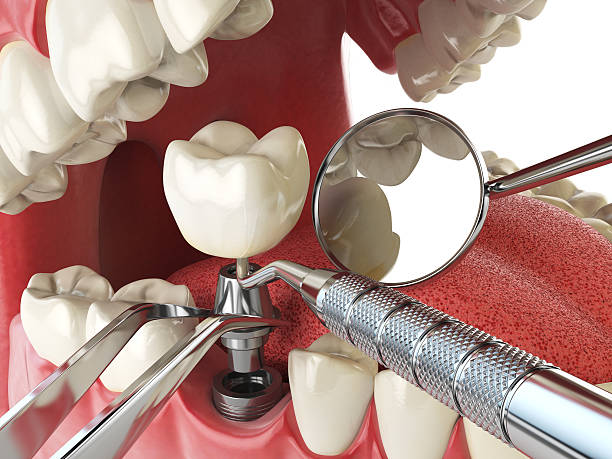 Best Weekend Emergency Dentist in Hutchison, VA